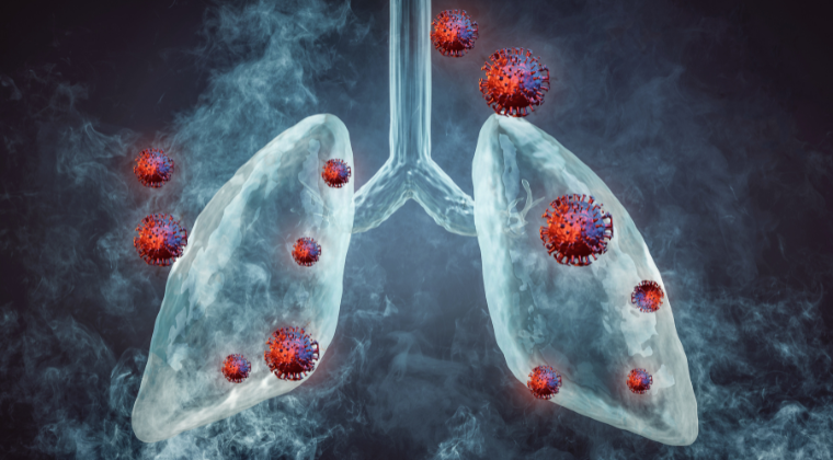 Chronic Respiratory Diseases